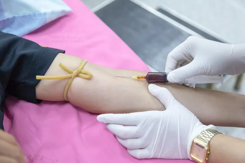 Healthcare professional drawing a blood sample from a patient’s arm for testing to diagnose and monitor acute blood cancer (acute leukemia)