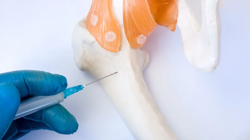 Medical illustration of a bone marrow biopsy procedure used to diagnose leukemia