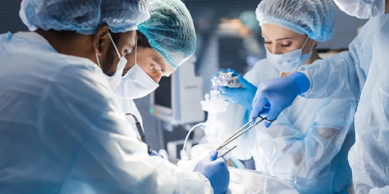 Stage 1 Colon Cancer Team of surgeons performing a surgical procedure to remove colon cancer at stage 1