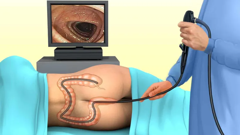 Doctor performing colonoscopy to detect polyps and tumors in the colon