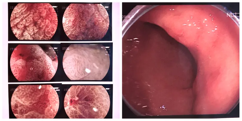 Endoscopic images of the stomach used to accurately diagnose the presence of gastric cancer