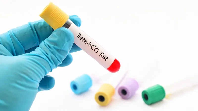 Beta-hCG blood test used in diagnosing gestational trophoblastic disease and choriocarcinoma