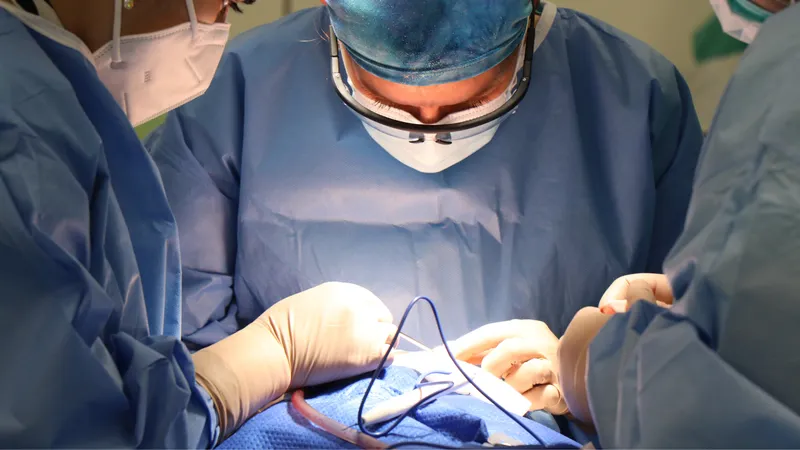 Urothelial Carcinoma Surgeons performing surgery to treat urothelial carcinoma, a type of urinary tract cancer.