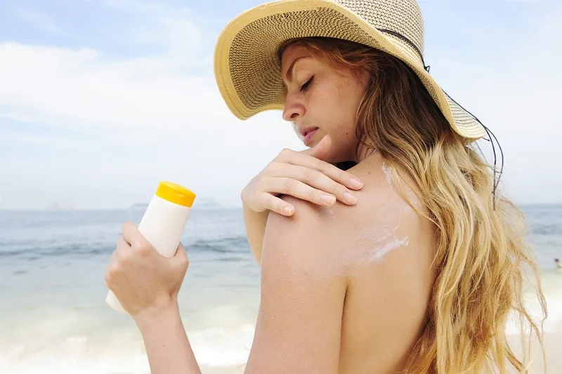 Psoriasis Woman applying sunscreen on shoulder to protect skin from sun exposure