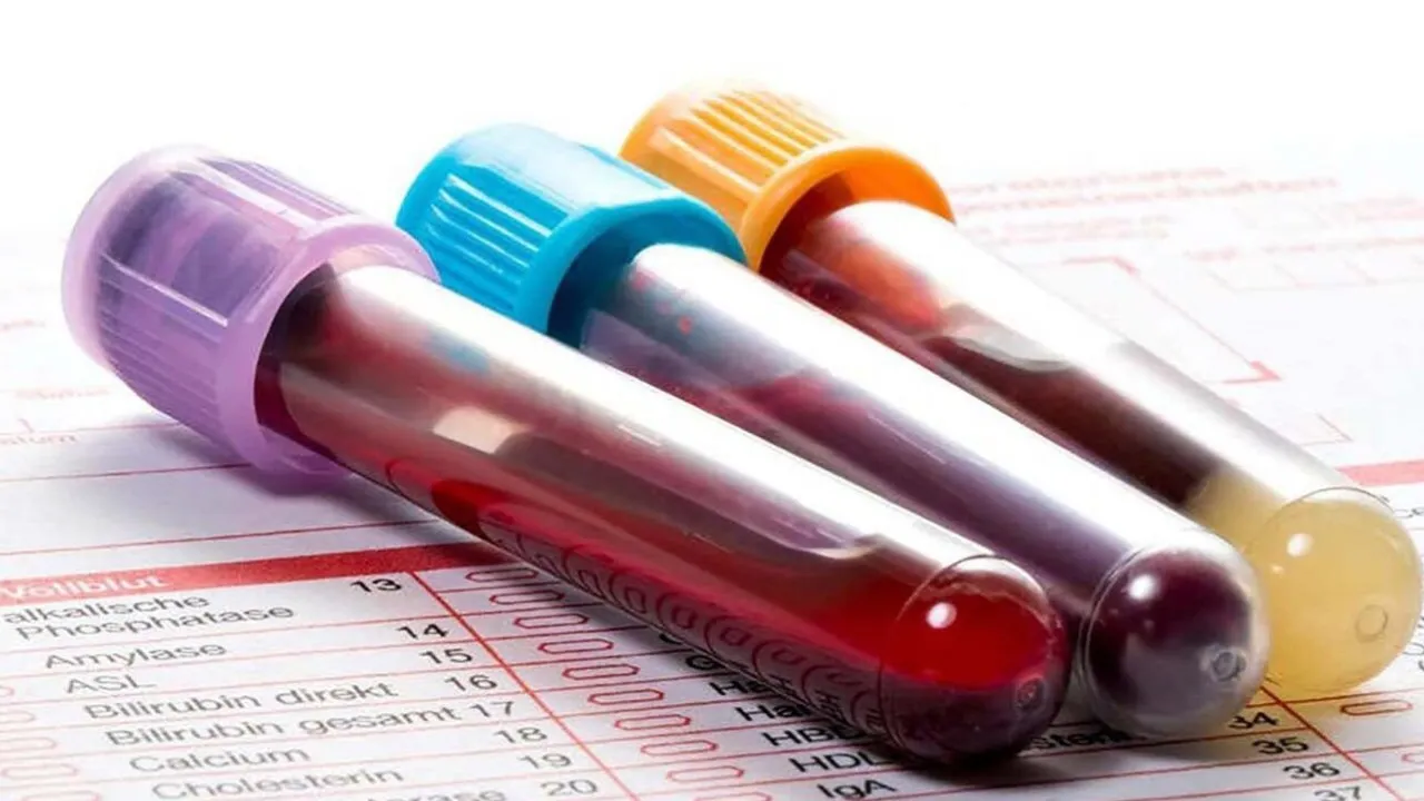 Multiple blood sample tubes prepared for laboratory analysis and diagnostic testing