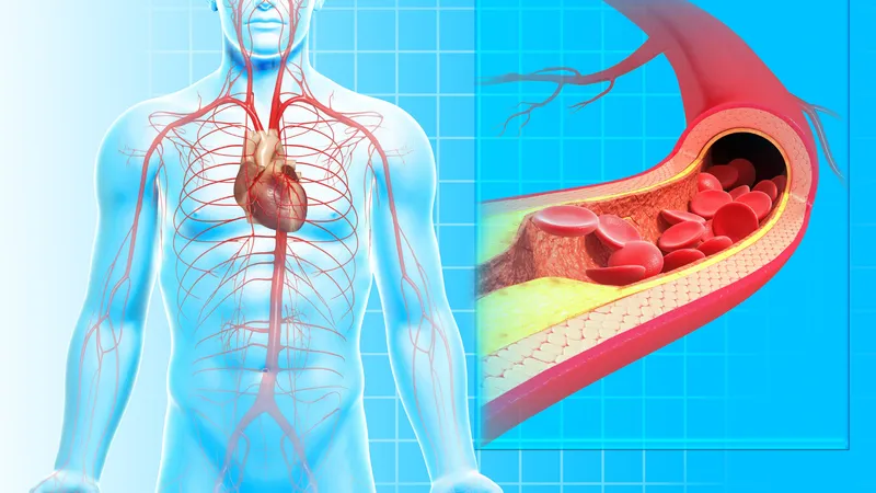 Illustration showing blood flow and cholesterol buildup in an artery, highlighting the importance of controlling blood sugar and cholesterol to prevent heart attack.