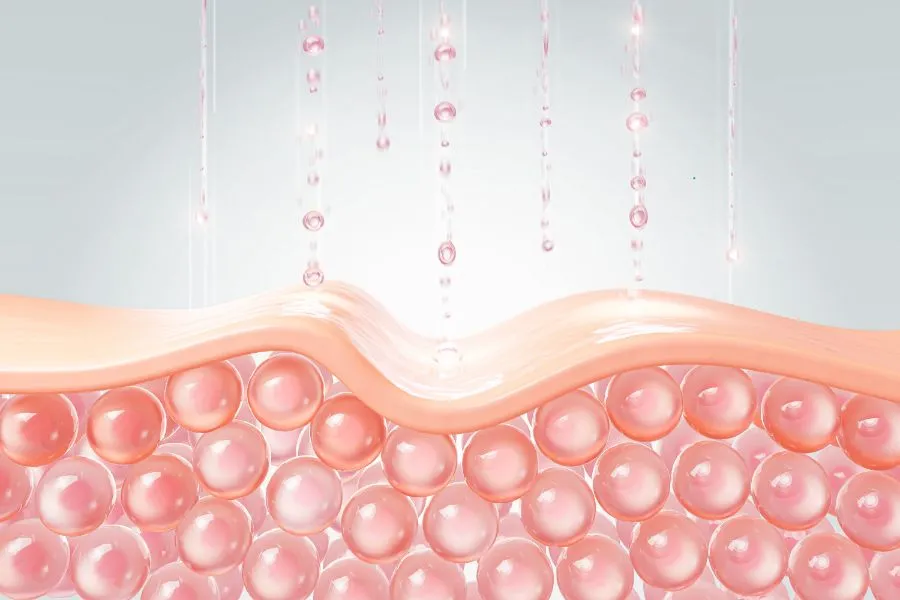 Illustration showing excess collagen buildup leading to skin thickening in scleroderma