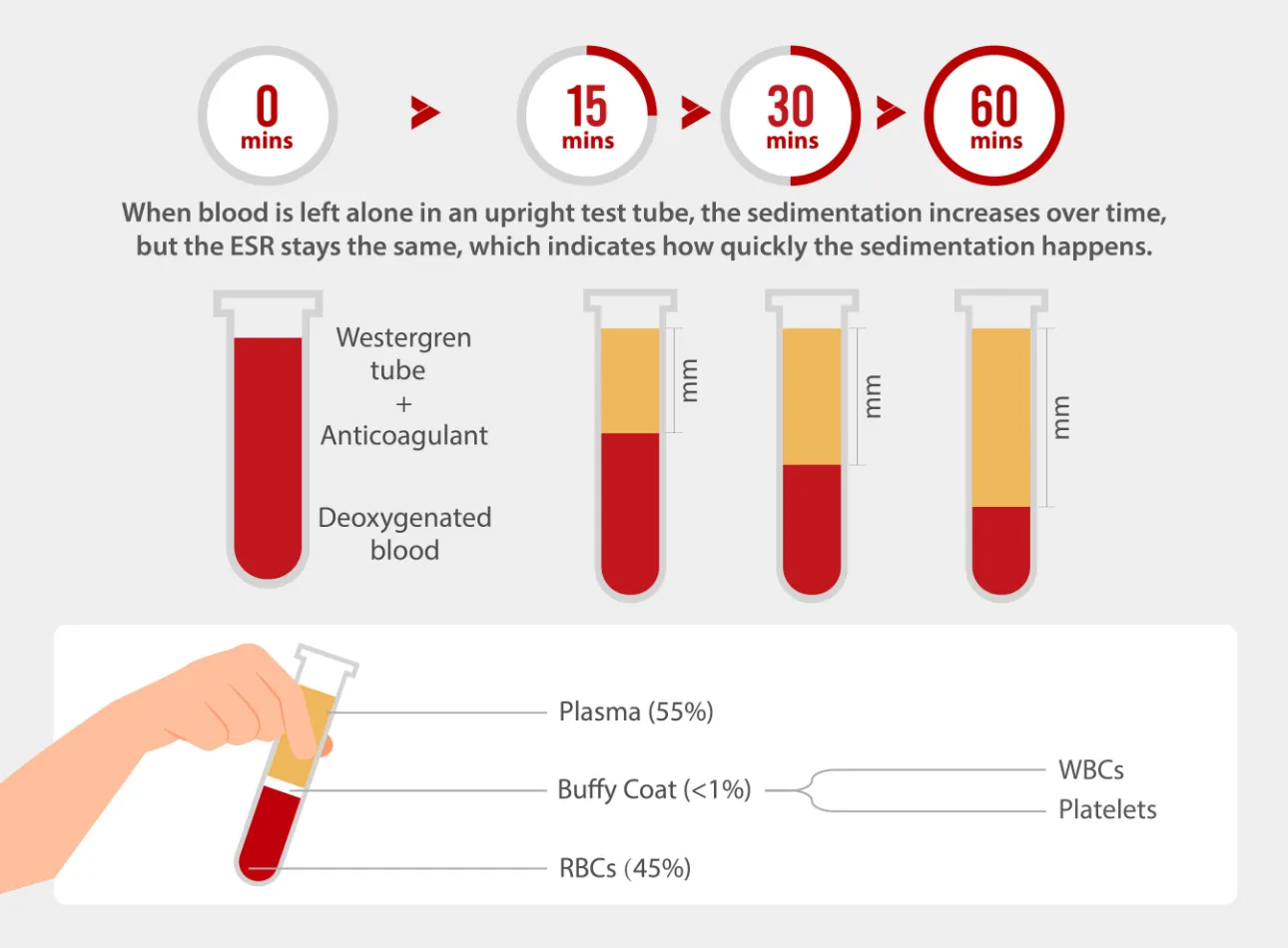 Diagram showing blood sedimentation process over time in ESR test tubes.