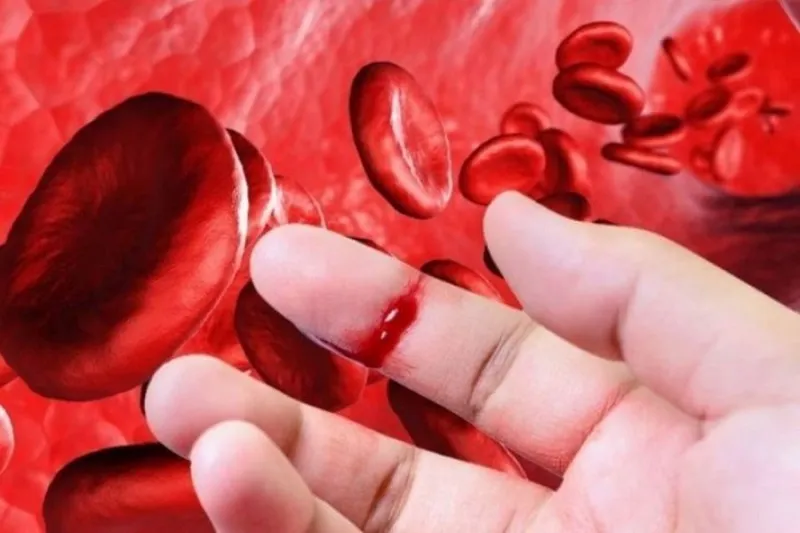 A person with a bleeding finger illustrating hemophilia, a blood clotting disorder