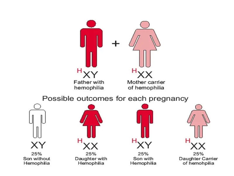 Genetic inheritance diagram showing how hemophilia is passed from parents to children through the X chromosome