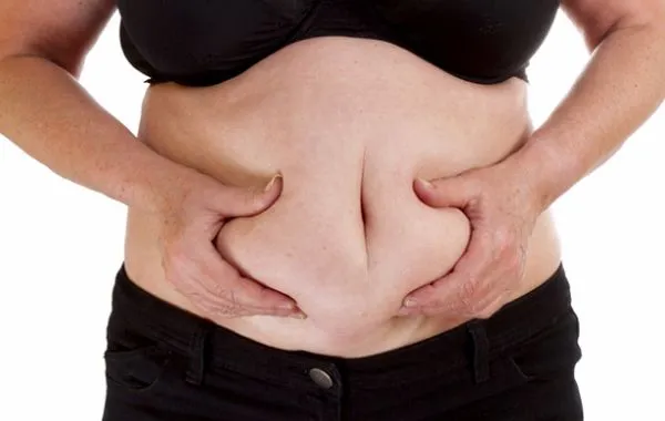 abnormal fat distribution in lipodystrophy affecting abdomen