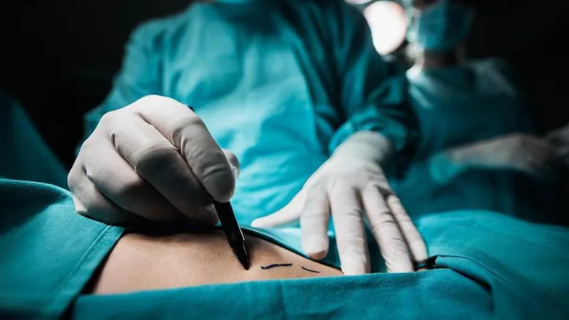 Surgeon performing surgery to remove a liposarcoma tumor from the body