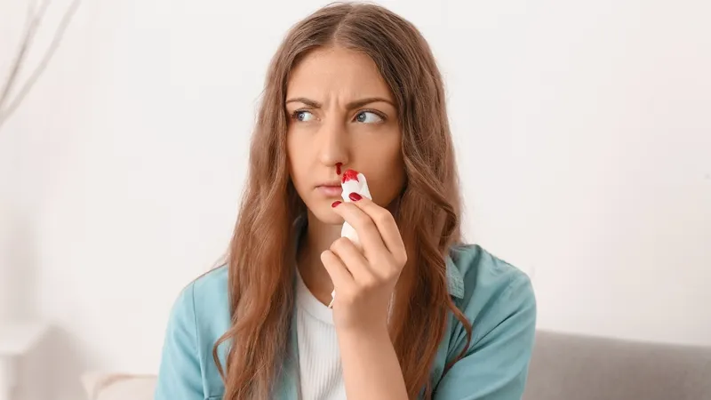 Thrombocytosis Woman experiencing nosebleed, a possible symptom of thrombocytosis