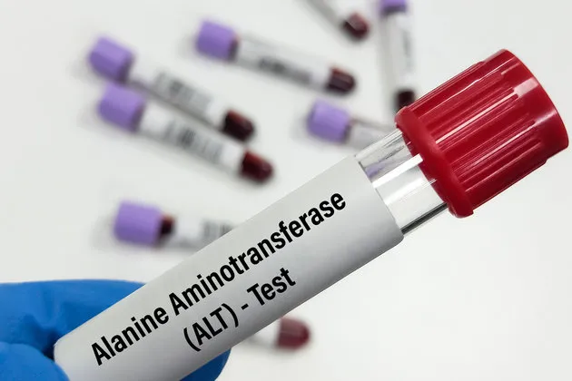 A laboratory technician in blue gloves holding a blood sample tube labeled "Alanine Aminotransferase (ALT) - Test," with other tubes blurred in the background.