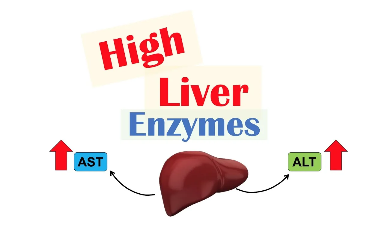 A medical illustration showing a human liver with upward red arrows pointing to increased AST and ALT labels, signifying high liver enzyme levels.