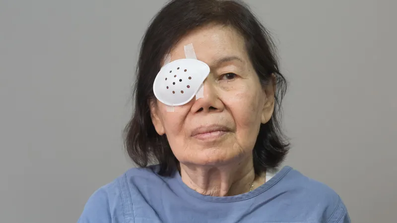 A close-up of an elderly woman wearing a protective eye patch (eye shield) over her right eye, likely recovering after cataract surgery. The patch is white with small ventilation holes and is secured by medical tape. She is wearing a blue hospital gown.