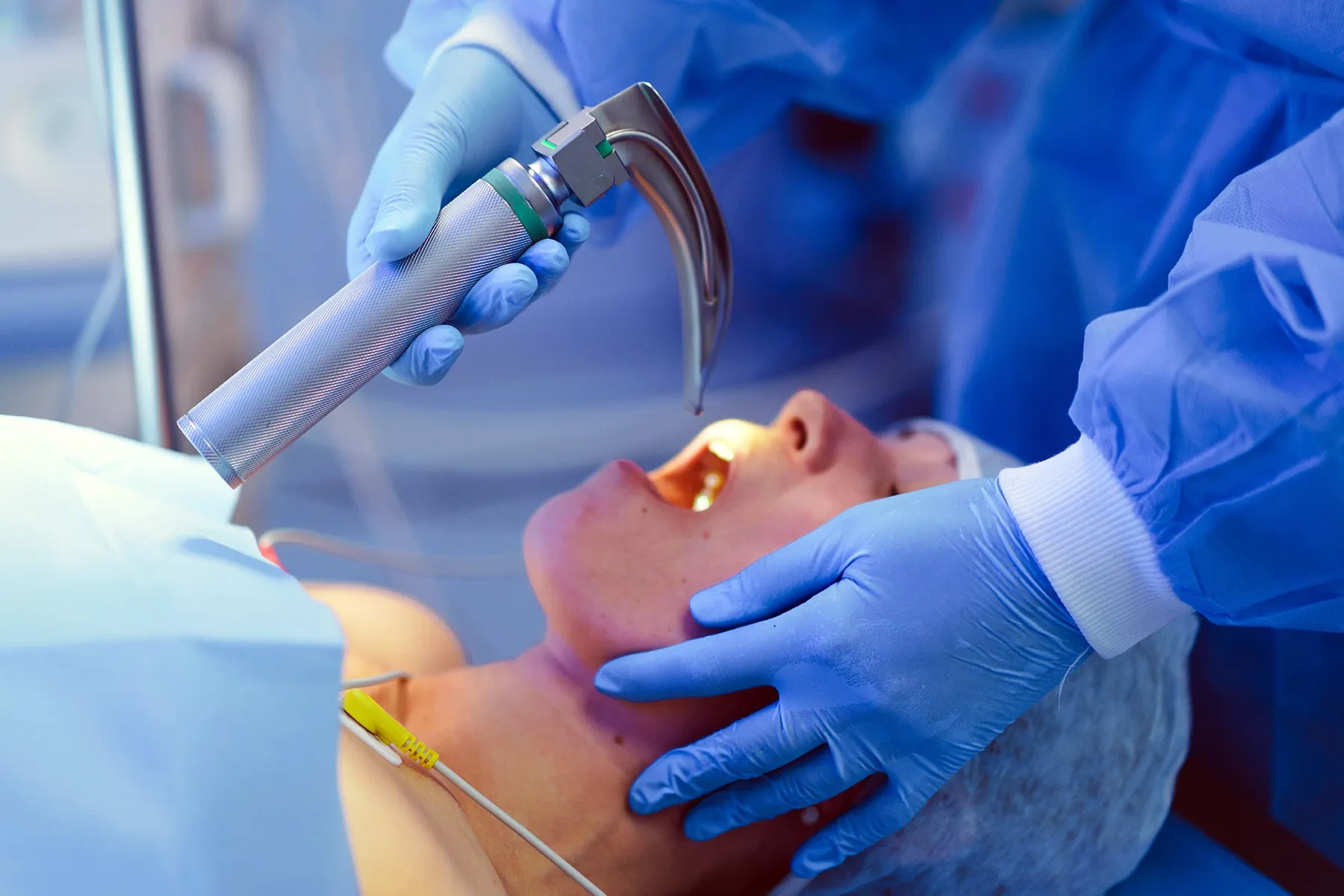 Voice Disorders A medical professional performing a direct laryngoscopy to examine a patient's vocal cords and evaluate voice disorders
